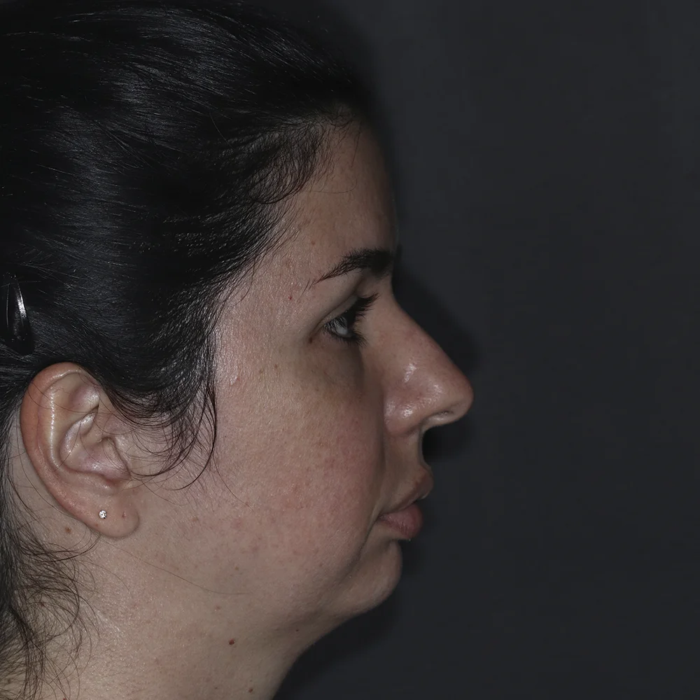 Depois